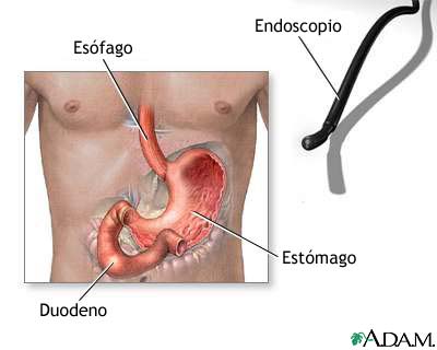 Endoscopia g&aacute;strica