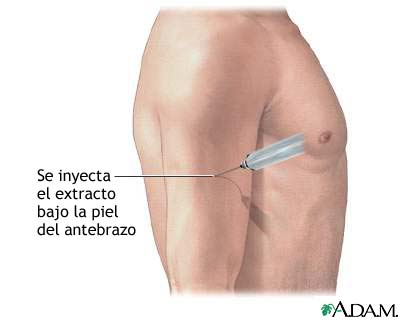 Inyecci&oacute;n de ant&iacute;geno