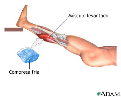 Tratamiento para distensi&oacute;n de la rodilla