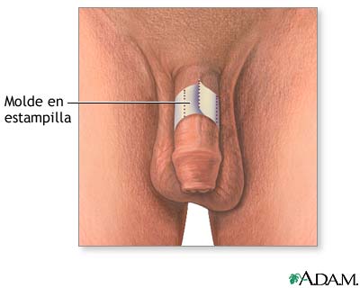 Autoexamen de erecci&oacute;n