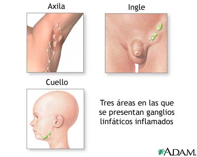 Gl&aacute;ndulas sudor&iacute;paras