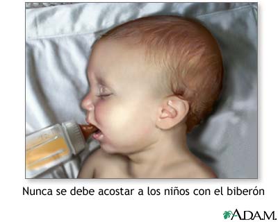 Caries dentales por el biber&oacute;n