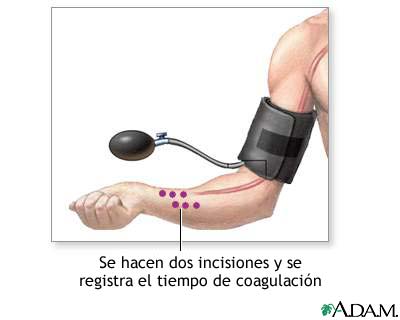 Prueba de coagulaci&oacute;n