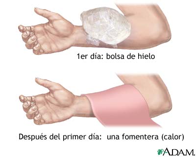 Tratamiento de contusiones