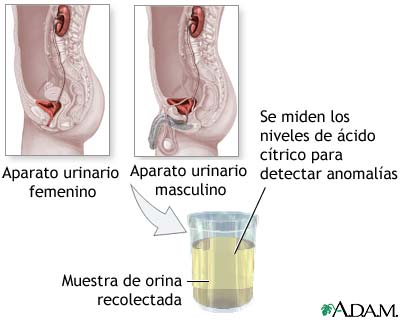 Prueba del &aacute;cido c&iacute;trico en la orina