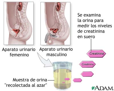 Prueba de creatinina en orina