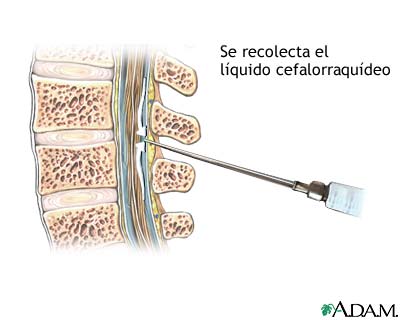 Qu&iacute;mica del LCR