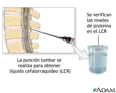 Examen de prote&iacute;na del LCR