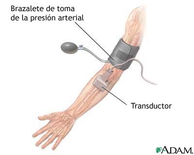 Examen de ultrasonido D&uacute;plex/doppler