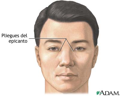 Pliegues del epicanto