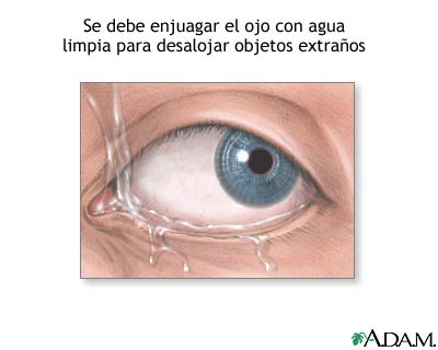 Objetos extra&ntilde;os en el ojo