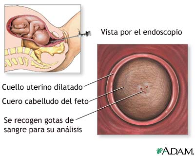 Examen sangu&iacute;neo fetal