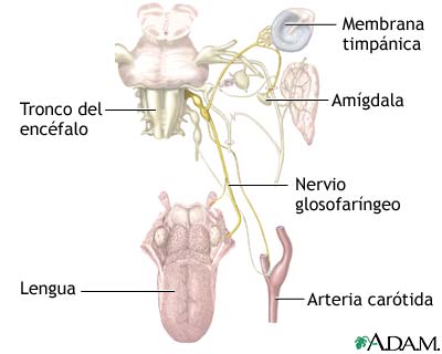 Neuralgia glosofar&iacute;ngea