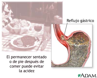 Prevenci&oacute;n de la aced&iacute;a