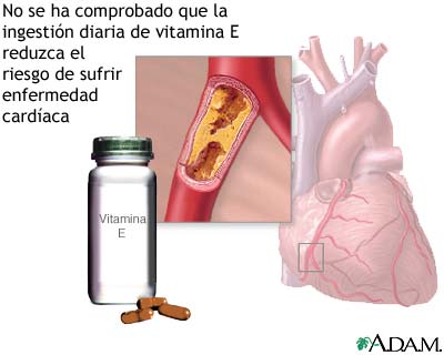 Vitamina E y la enfermedad card&iacute;aca