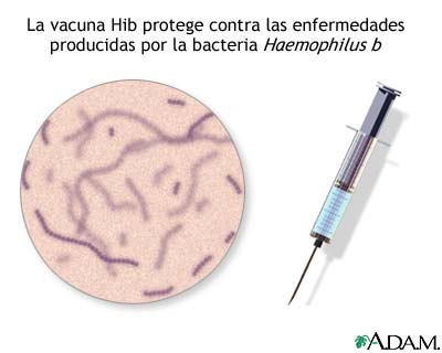 Inmunizaci&oacute;n o vacuna contra Hib