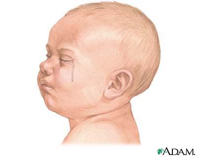 Llanto excesivo (0 a 6 meses)