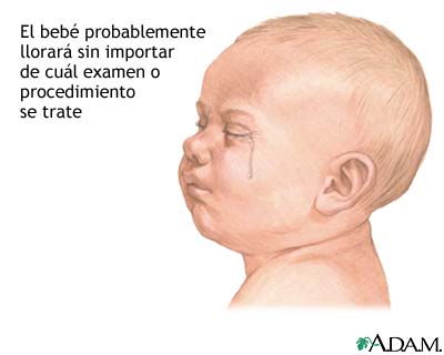 Preparaci&oacute;n para un examen o procedimiento en un ni&ntilde;o menor de un a&ntilde;o
