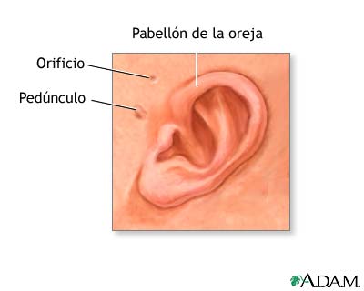 Anatom&iacute;a de la oreja del reci&eacute;n nacido