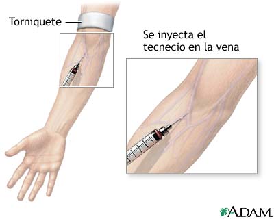Gammagrama del h&iacute;gado