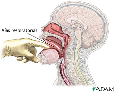 Verificaci&oacute;n de v&iacute;as a&eacute;reas