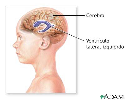 Ventrculos del cerebro