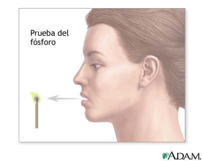 Prueba del f&oacute;sforo