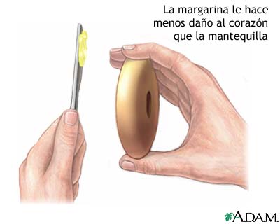 Margarina contra mantequilla