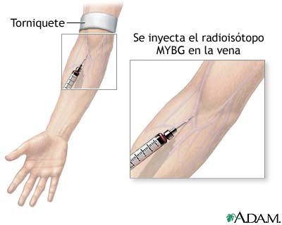 Inyecci&oacute;n de MIBG