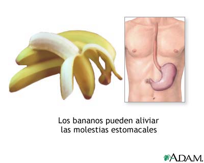 Bananas y n&aacute;useas