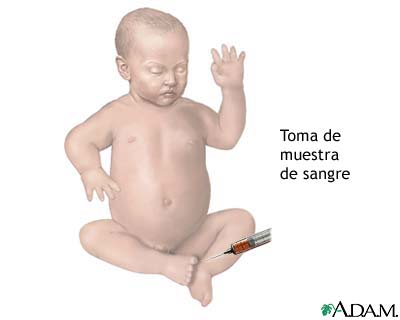 Toma de muestra de sangre de un beb&eacute;