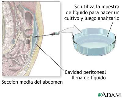 Cultivo peritoneal