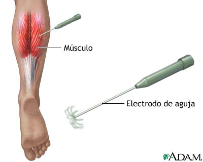Electromiograf&iacute;a