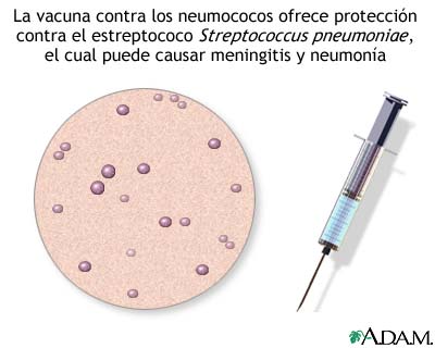 Vacuna antineumoc&oacute;cica