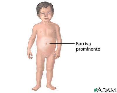 Ni&ntilde;os barrigones