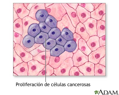 Proliferaci&oacute;n de c&eacute;lulas