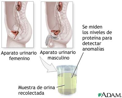 Prueba de prote&iacute;na en la orina