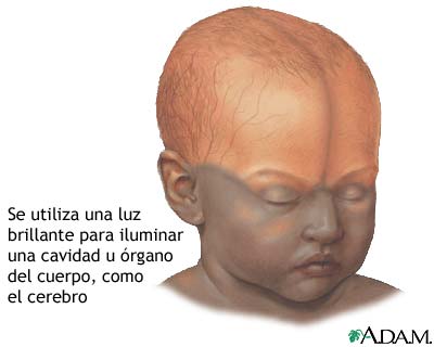 Examen del cerebro del lactante