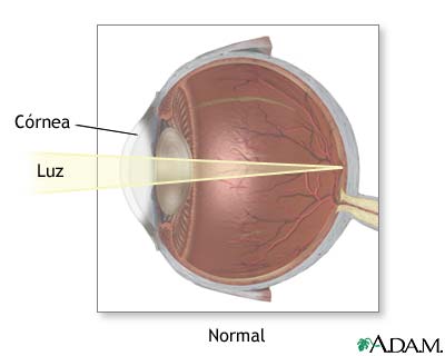 Visi&oacute;n normal