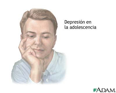 Depresi&oacute;n en el adolescente