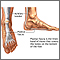 Fascia Plantar
